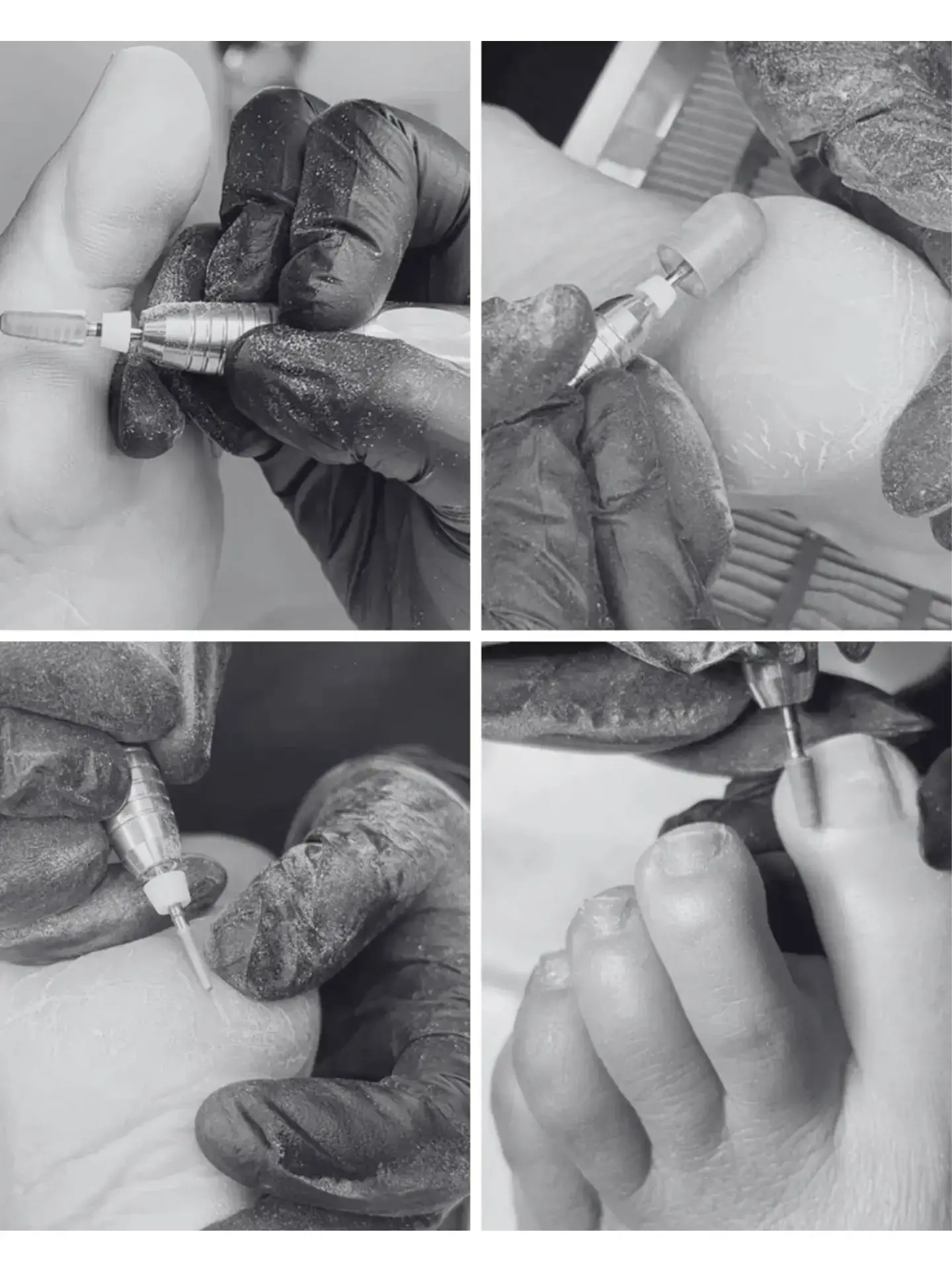 A collage of four black and white photos shows gloved hands using an electric tool to perform pedicure procedures on a person's feet, focusing on smoothing and cleaning the skin and nails.