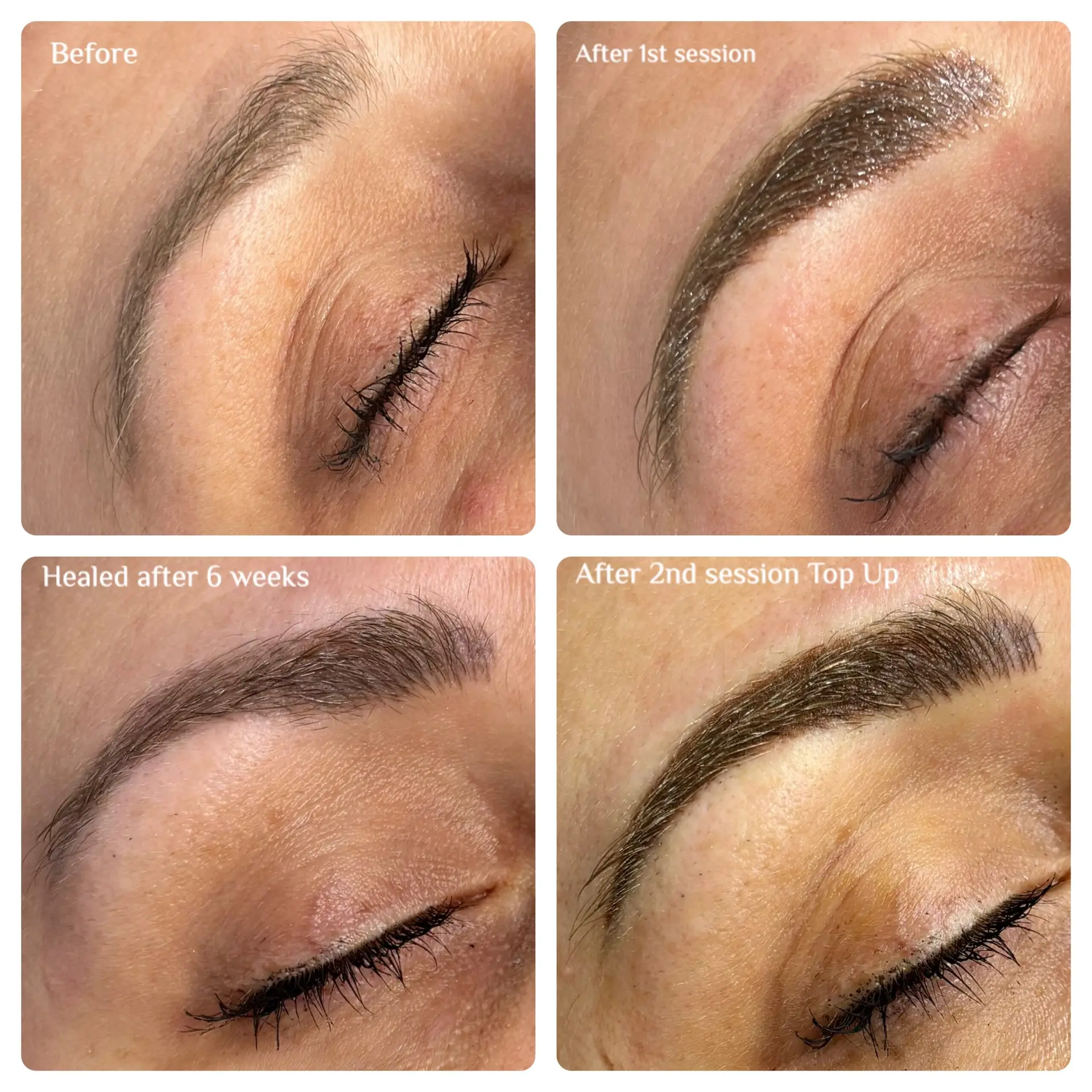 A collage of four close-up images showing the progression of an eyebrow cosmetic procedure: before, after the first session, healed after six weeks, and after a second session top-up. Eyes are closed in each photo.